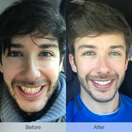 -GB-_Before _After_aaron-optimized-image