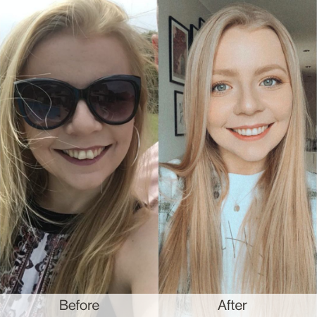 UK_Before After_450x450_Chloe